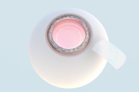 PRL手術(shù)是什么意思？